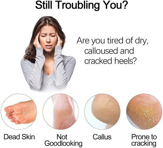 Vacuum Callus Remover & Dead Skin Exfoliator for Foot Care