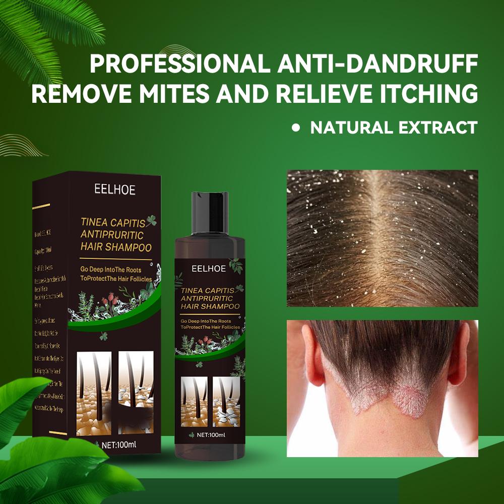 EELHOE Anti-Dandruff Shampoo Itch Relief