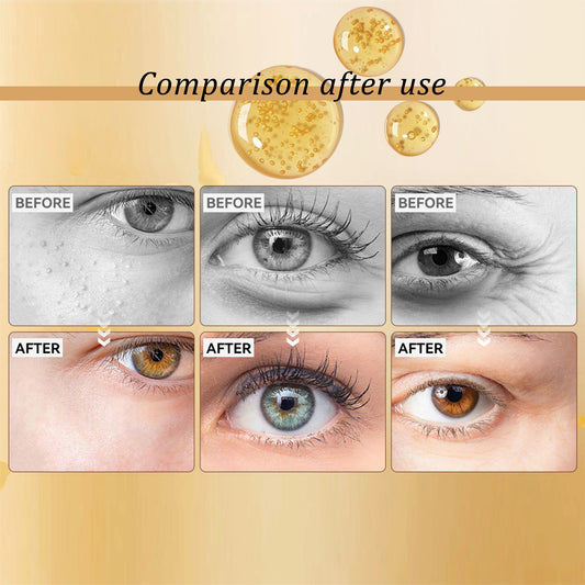 Hoygi Snail Peptide Eye Cream