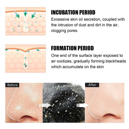 Blackhead Nose Strips Deep Pore Cleansing