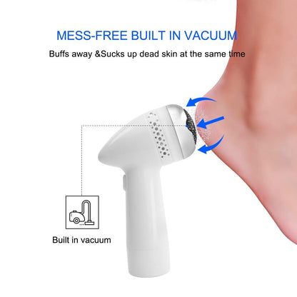 Vacuum Callus Remover & Dead Skin Exfoliator for Foot Care