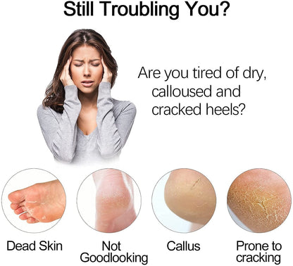 Vacuum Callus Remover & Dead Skin Exfoliator for Foot Care